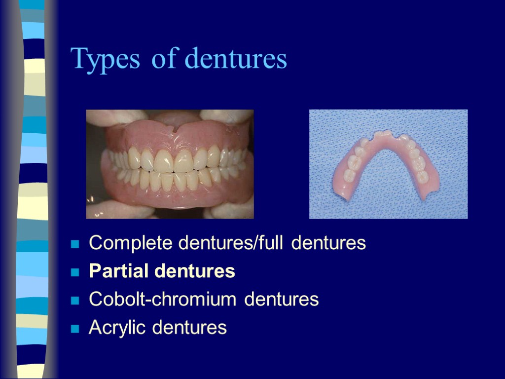 Types of dentures Complete dentures/full dentures Partial dentures Cobolt-chromium dentures Acrylic dentures